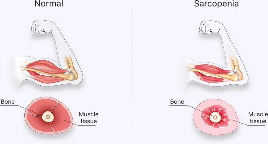 Lean Muscle Slows Aging